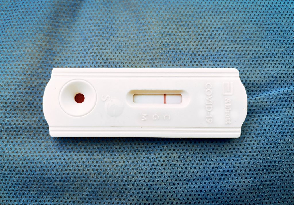 Eine Corona-Schnelltest-Kassette auf einer blau strukturierten Oberfl&auml;che zeigt eine einzelne rote Linie im Kontrollbereich, was auf ein negatives Ergebnis hinweist.