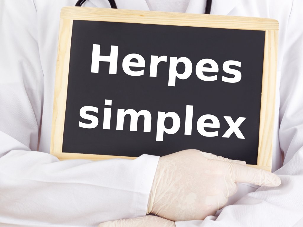 Doctor shows information: herpes simplex