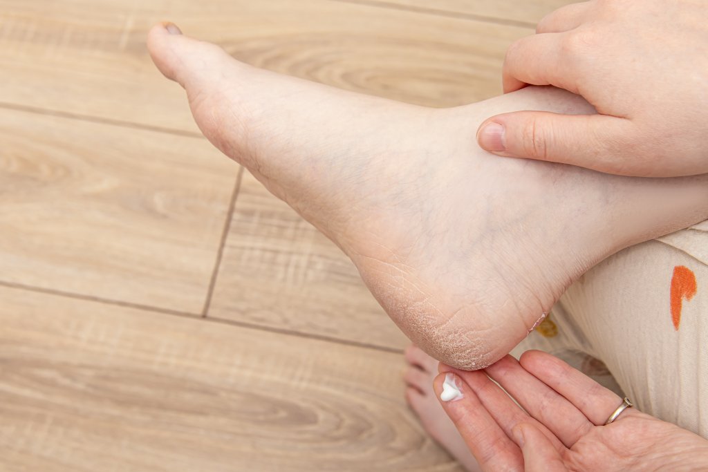 Eine Person cremt die trockene, rissige Haut an ihren F&uuml;ssen ein, w&auml;hrend sie auf einem Holzboden sitzt und sicherstellt, dass ihre F&uuml;sse in guten H&auml;nden sind.