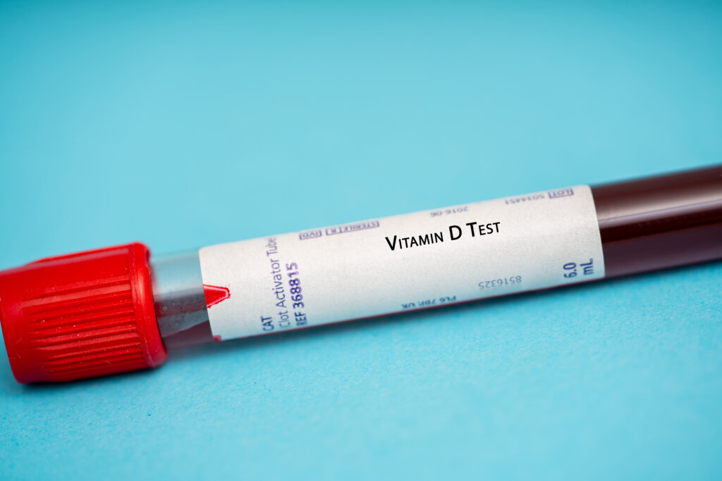 Ein Blutprobenfl&auml;schchen mit einer roten Kappe mit der Aufschrift Vitamin D Test (Vitamin D Messung) liegt auf einer blauen Fl&auml;che. Das Fl&auml;schchen mit dunklem Blut und Milliliter-Markierungen ist f&uuml;r die Vitamin-D-Analyse vorbereitet.